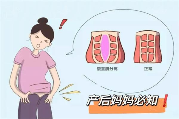 产后复原黄金期是什么时候