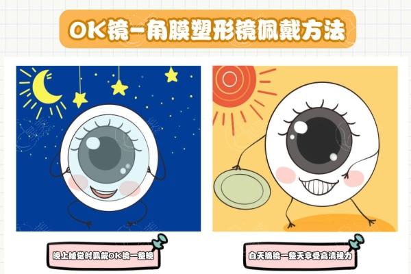 儿童ok镜哪个品牌好