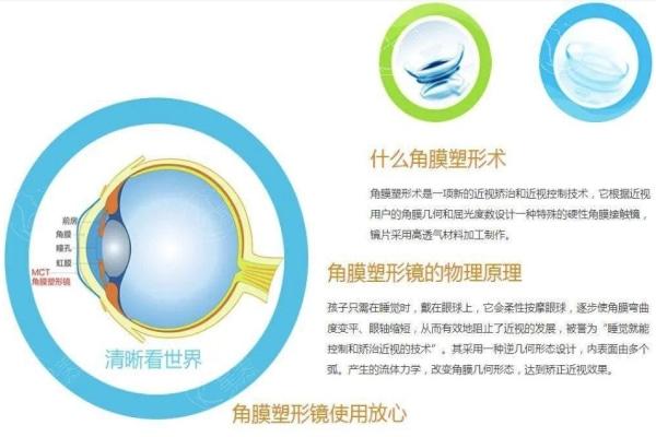 儿童ok镜哪个品牌好