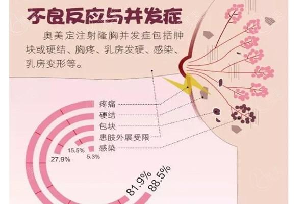 奥美定
