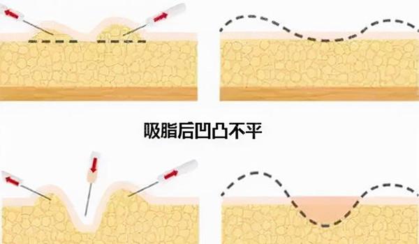 中信惠州医院美容科