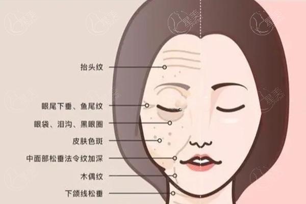 筋膜层提升费用大概多少