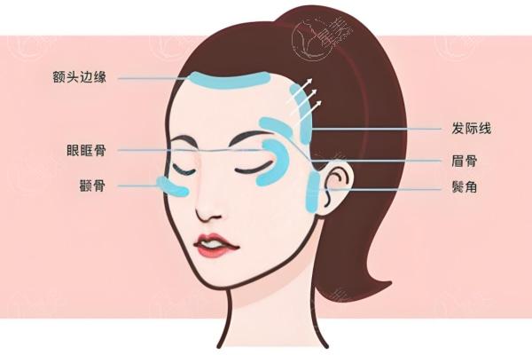 测评:2025杜太超拉皮手术价格贵吗 价格合理技术牛快来看