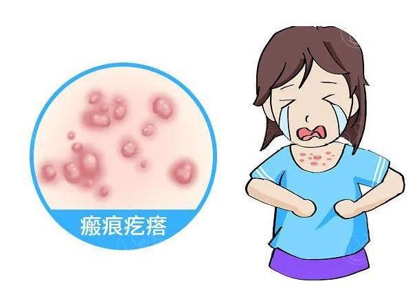 贵阳祛疤痕哪家医院好?华医|翡丽斯|甲秀这三家祛疤技术正规
