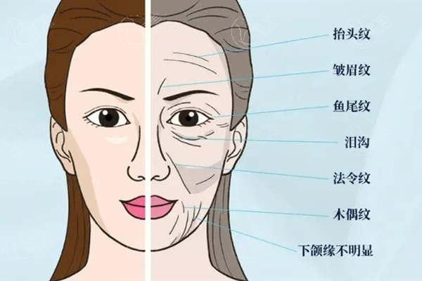 抗衰老