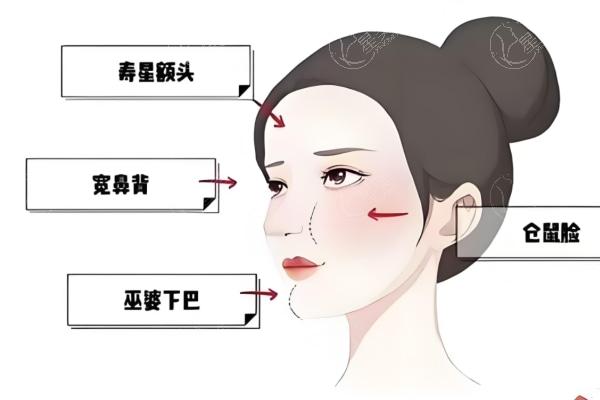 馒化脸哪个医生做的好?蒋铮铮/隋冰/周云超/齐云香修复技术牛满意度高