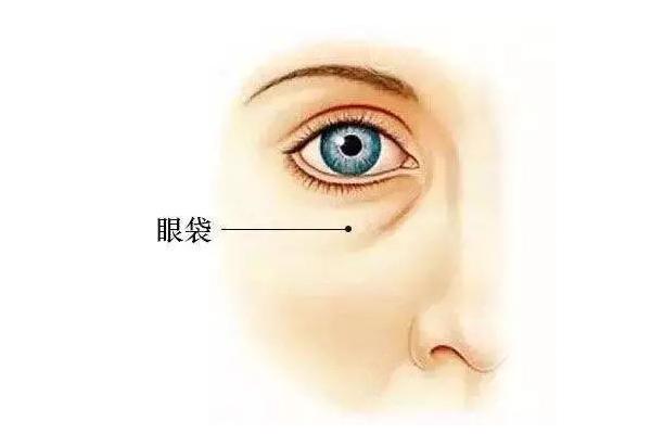 王杨医生卧蚕去眼袋的收费与技术优势解析