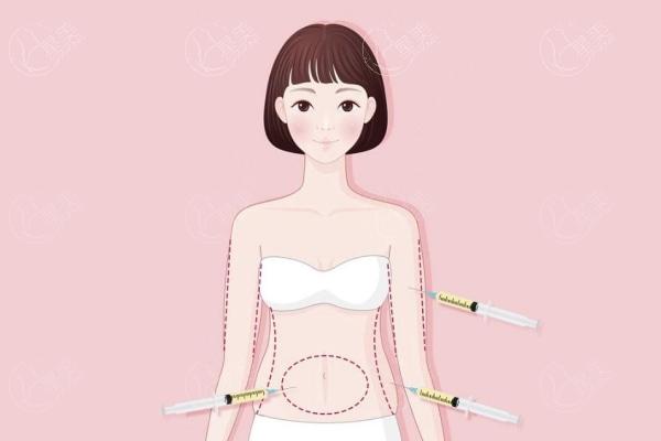 包头做吸脂多少钱一次?腰腹环吸+手臂吸脂去哪家医院更可靠?