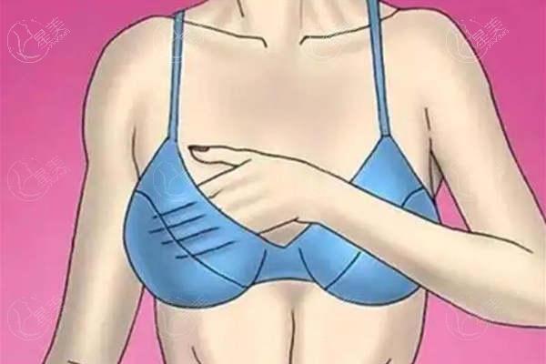 福建隆胸医生排名前十名单