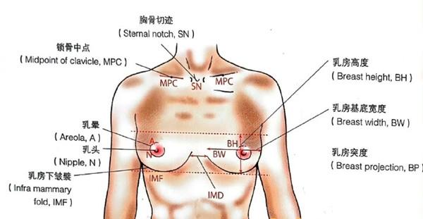 成都隆胸医生庄建波怎么样？
