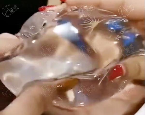 棉花糖丰胸技术详解：