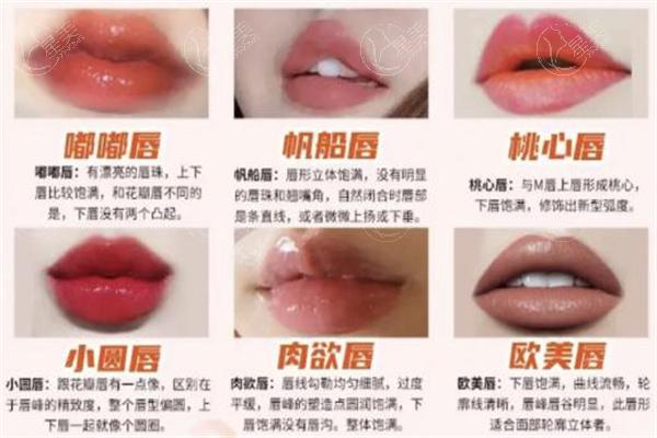 玻尿酸丰唇哪个品牌好？对比姣兰/瑞蓝/乔雅登等品牌的维持时长及价格看看吧