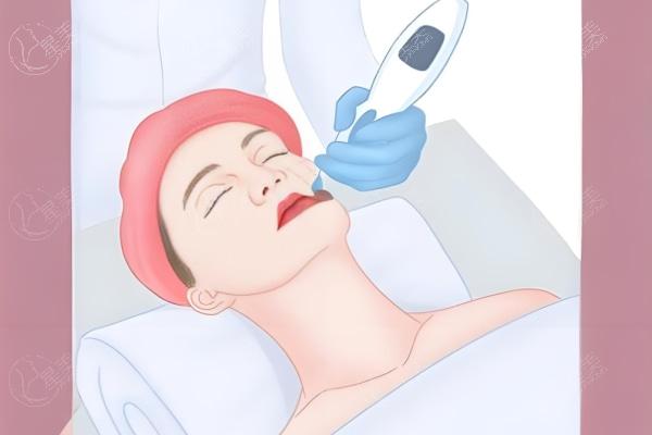 北京做热玛吉的医生哪个好?这几位医生技术口碑好细心附价格表