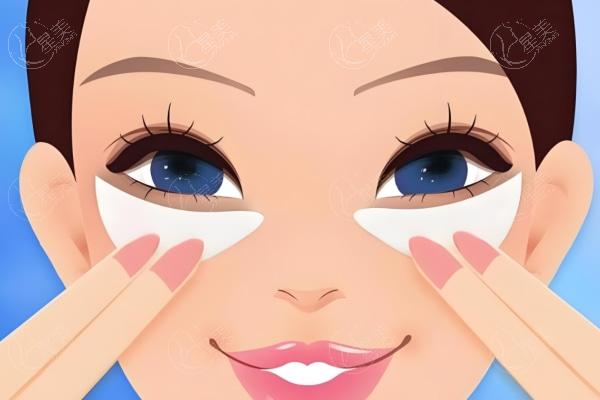 成都王立鹏医生怎么样?王立鹏双眼皮修复技术好自然和谐满意度高