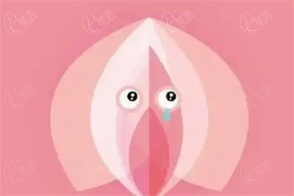 国内做私密修复手术多少钱