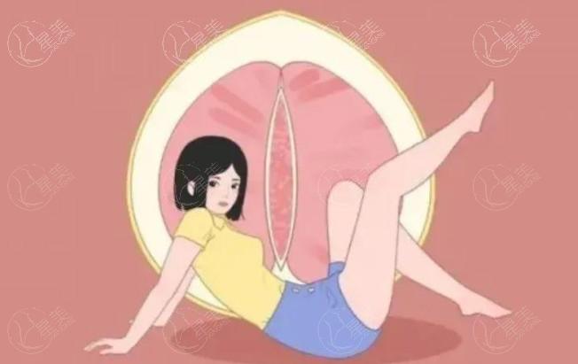 私密紧缩针有用吗?打紧缩针可以持续多久？