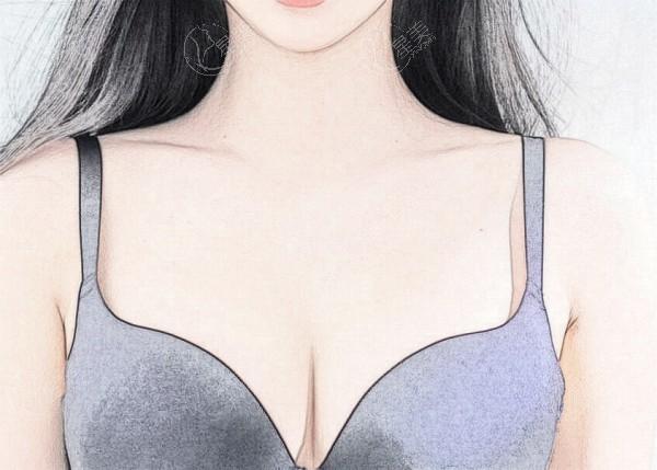 北京吴继东隆胸怎么样?擅长多种胸部整形手术审美好口碑更好!
