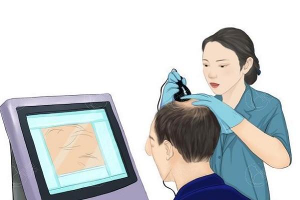 南京植发较好的正规医院排名前五公布!对比来看新生/熙朵/建国领秀植发哪家技术好?