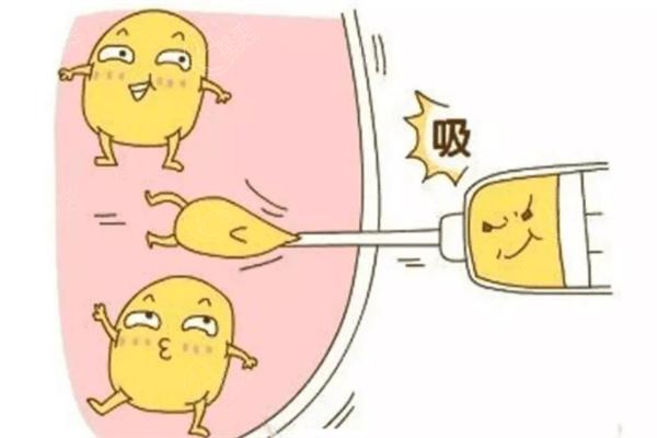 张让虎吸脂怎么样？