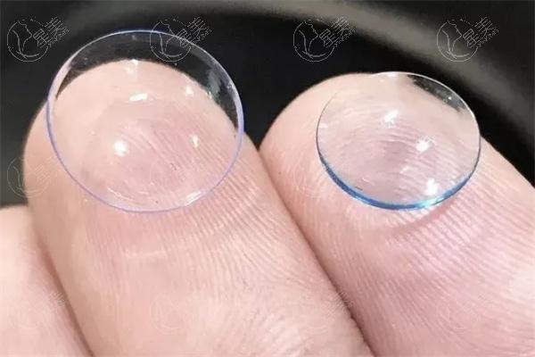 爱尔眼科近视矫正眼镜多少钱?分享爱尔眼科近视眼镜价格表可知几百元起