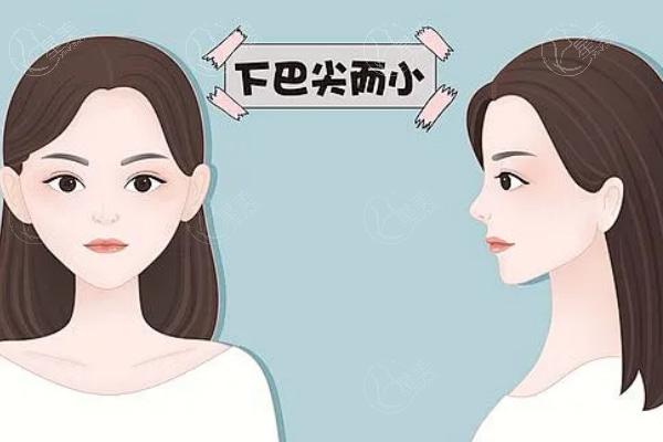 韩国伊美芝整形医院接待国人吗?接待做轮廓磨骨技术口碑实力强