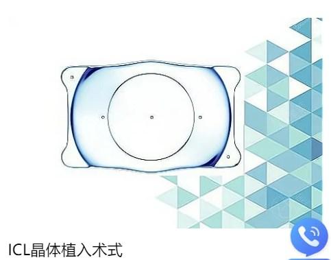 重庆星辉做晶体植入EVO+ICL V5手术怎么样?详细了解技术实力可知