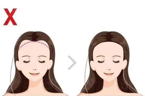 合肥头发种植技术好的医院排名