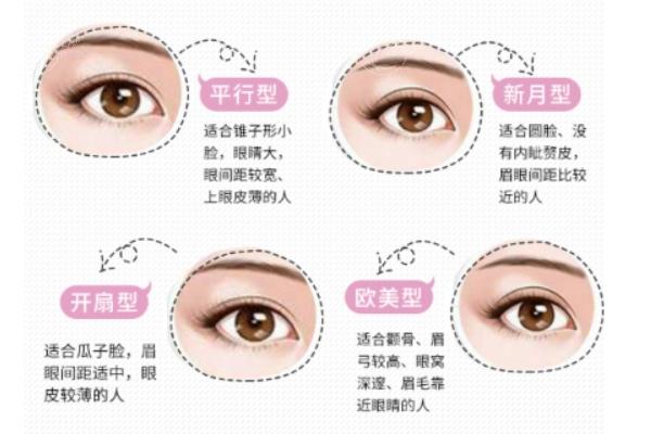 吕方中双眼皮价格收费参考：眼角、眼袋、双眼皮及修复费用解析