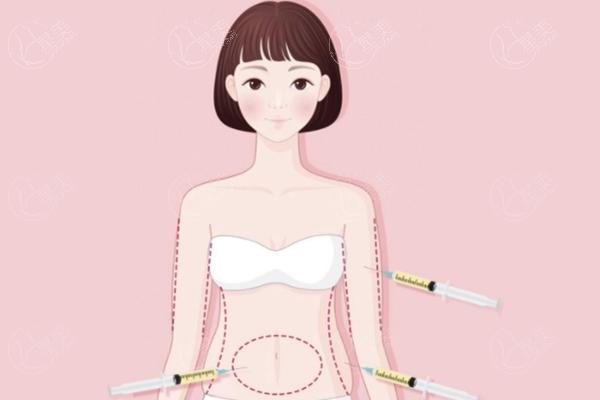 超脂塑吸脂和黄金微雕哪个好？