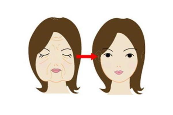 广州全脸筋膜提升医院排名