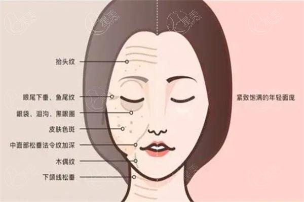 广州全脸筋膜提升医院排名