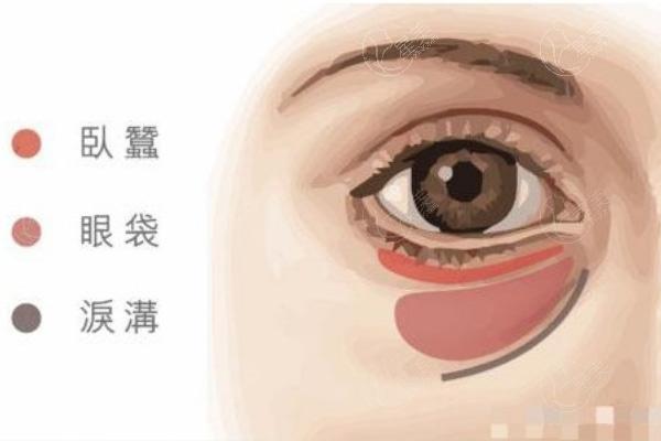 北京美莱整形做眼修复大概要多少钱?7800元起根据情况具体定价