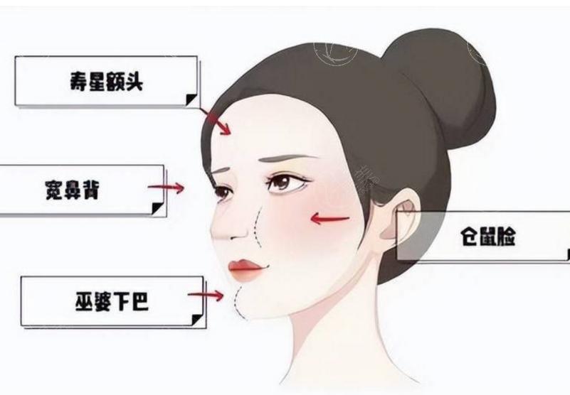 馒化脸修复多少钱