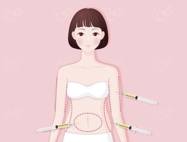 5g光雕吸脂2.jpg