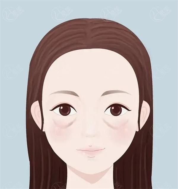 眼袋5.jpg