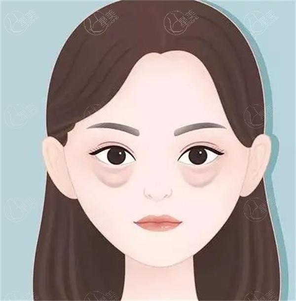 眼袋4.jpg