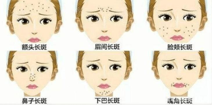 想知道深圳富华整形医美项目价格一览表 据说实力强且技术赞可入手