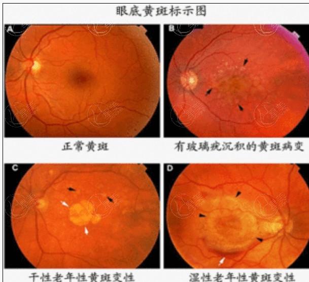 武汉表层EK便宜又好的医院 悦瞳、普瑞、爱尔这几家好且便宜