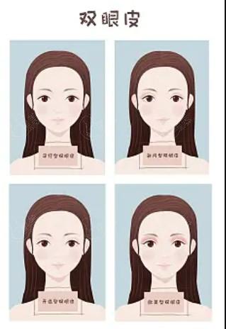 深圳面部奥美定取出有名的医院名单公布  艺星、弘美、阳光这几家很出名