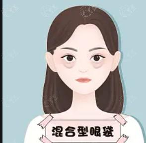 成都去妊娠纹便宜又好的医院有哪些 告诉你哪里做去妊娠纹技术更好！