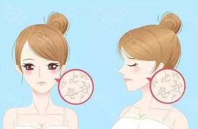 做了瘦脸手术前,这些疑虑你都想过吗?