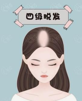 公开无锡整形医院鼻部整形价格一览表 网友直呼鼻头整形3000元+鼻小柱延长5000元+太实惠