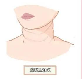 来看看青岛整形医院体型塑形收费标准一览 臀部吸脂3000起，收费透明技术好