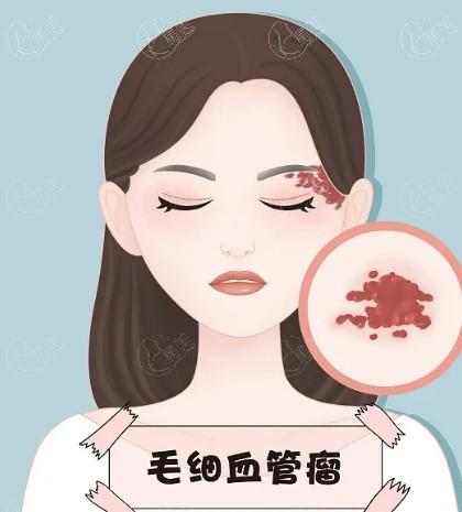 福州巨乳缩小哪家医院好？ 福州有名的是海峡、伽禾伽美医院、韩尔