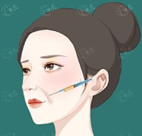2024成都整形医院其它整形收费标准 做富贵包4000/男变女100000挺便宜