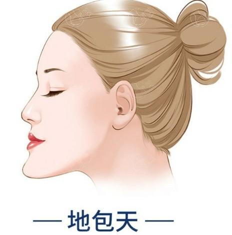 速览北京整形医院皮肤激光要多少钱 飞顿辉煌DPL精准嫩肤1000起