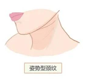 刷新青岛医美医院鼻部整形价格表更新 隆鼻/自体软骨隆鼻/手术缩小鼻头没想象的贵