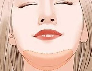 成都乳房缩小哪个医院可以做 现代、中银海、懿和唯美这几家好且便宜