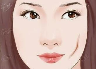武汉注射除皱去法令纹有名的医美医院排名 这些都是武汉正规且规模大的机构喔