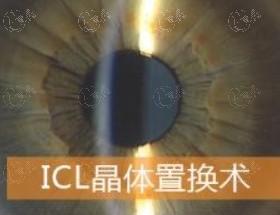 重庆3D-Smile全飞秒哪家医院好？ 重庆3D-Smile全飞秒性价比高的医院在此